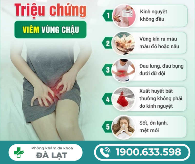 Hình ảnh minh họa